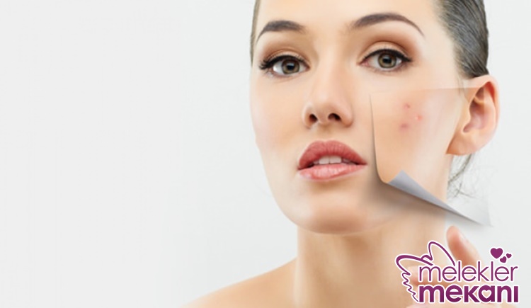 yüzde lekelenme nedne olur.jpg