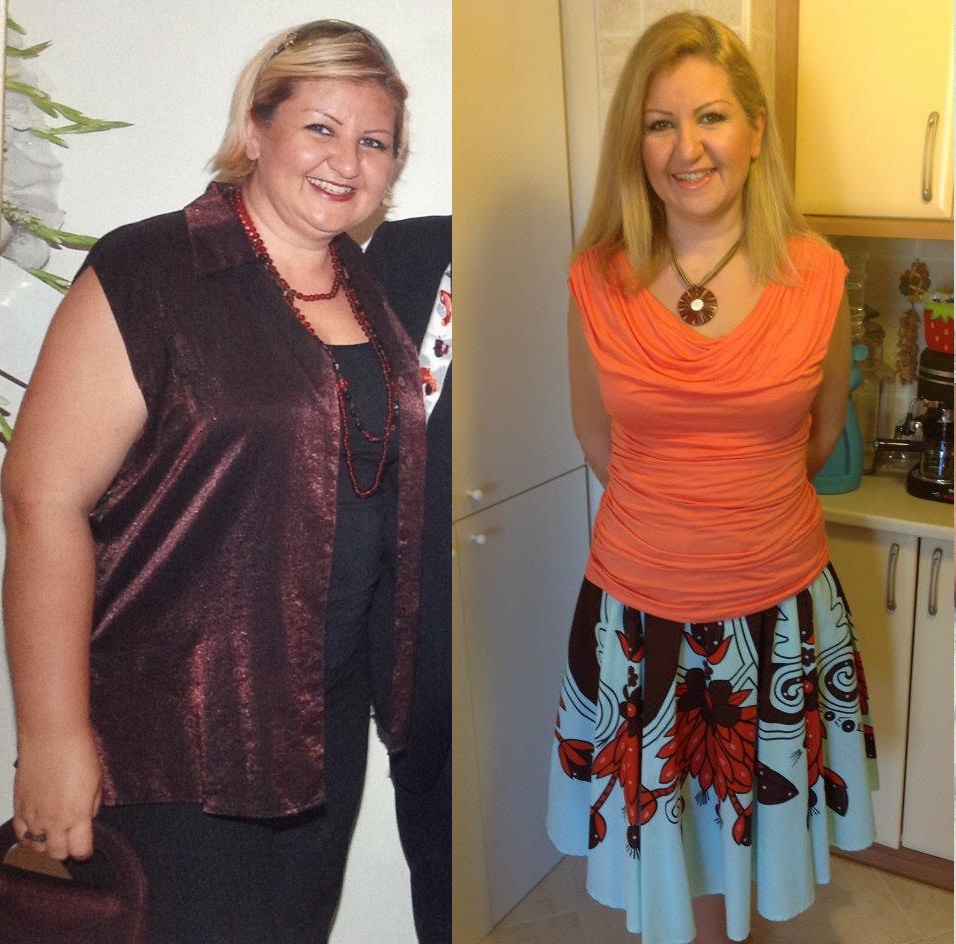 zayıflama öncesi sonrası.jpg