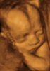 phoca_thumb_m_bebek-ultrason.jpg