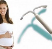 spiral varken hamilelik.jpg