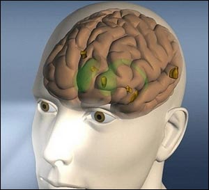 alzheimmer1-285.jpg