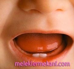 bebek-dis-cikartmasi4-1341.jpg
