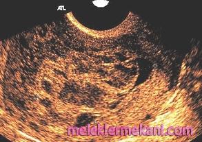 gebelik-belirtileri1-8301.jpg
