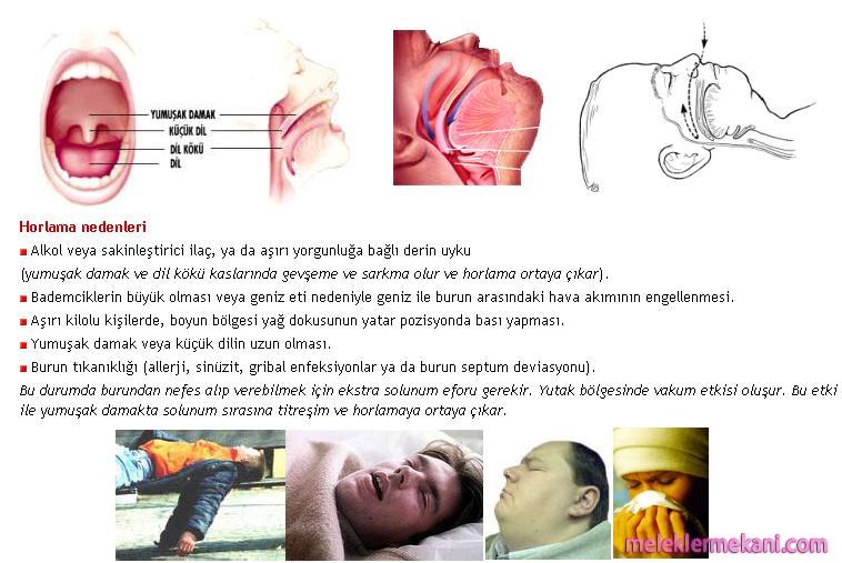 horlamak-4060.jpg