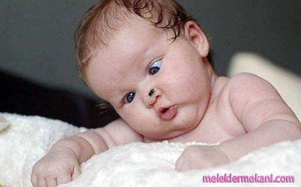 sinekli-bebek-9610.jpg
