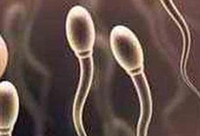 sperm-2887.jpg