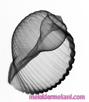 x_ray5-5524.jpg