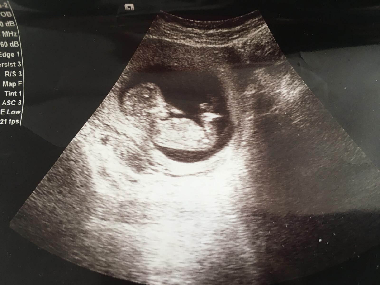 WhatsApp Image 2019-06-13 at 13.24.26.jpeg