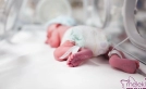 Prematüre Bebek Mucize Bebeklere Geniş Çaplı Bir Bakış