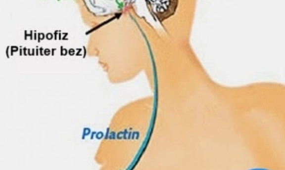 Süt Hormonu (Prolaktin) Yüksek Olanlar Hamile Kalabilir mi?